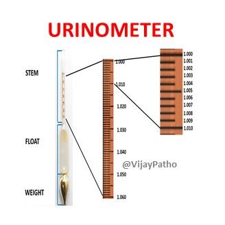 a urometer or a refractometer is used to measure the|urinometer for kidney function.